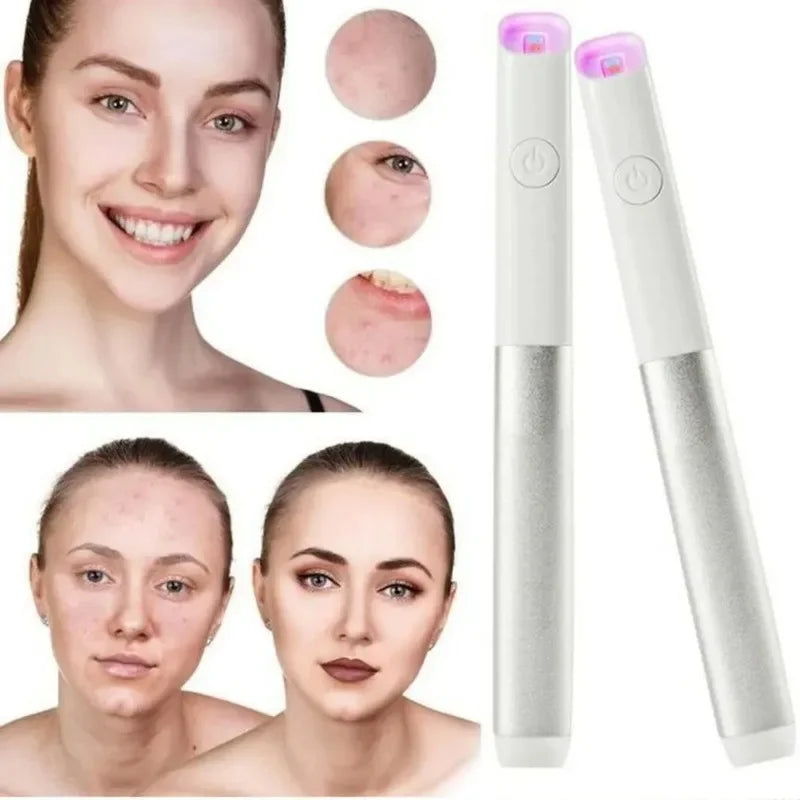 🛍️ LED Acne Behandelpen – 1+1 Gratis | Verwijdert Puistjes Snel & Pijnloos!
