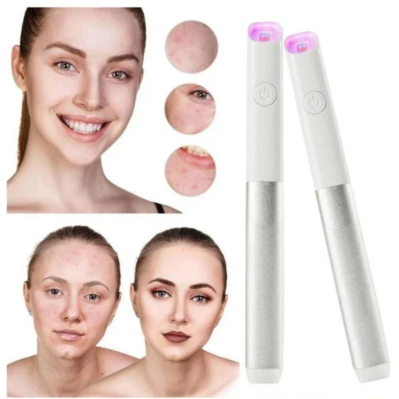 🛍️ LED Acne Behandelpen – 1+1 Gratis | Verwijdert Puistjes Snel & Pijnloos!
